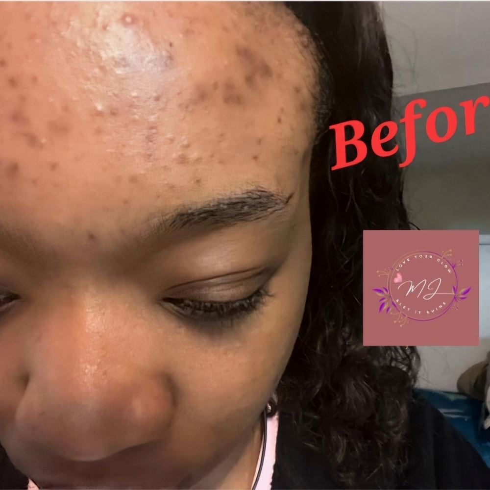 Exfoliator - Picture 2 of 8